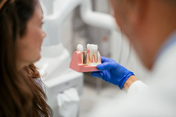 Dental Implants Stoney Creek & Hamilton | Fletcher Dental