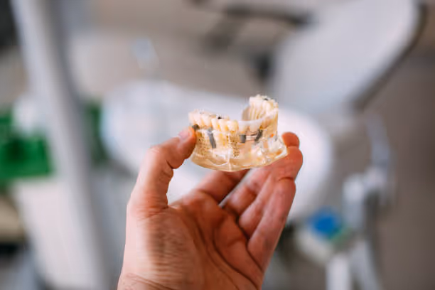 Dental Implants at Fletcher Dental Centre in Hamilton